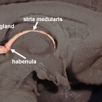 Article teaser image