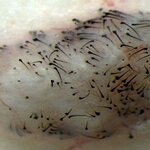 Article teaser image