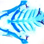 Article teaser image