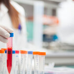 Article teaser image