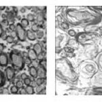 Article teaser image