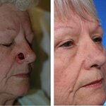 Article teaser image