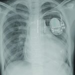 Article teaser image