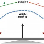 Article teaser image