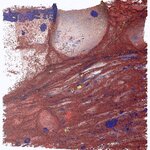 Article teaser image