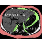 Article teaser image