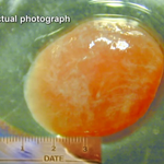 Article teaser image