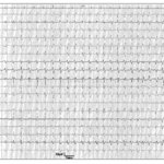 Article teaser image