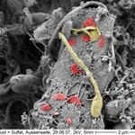 Article teaser image