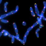 Article teaser image