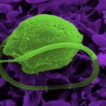 Article teaser image