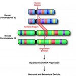 Article teaser image