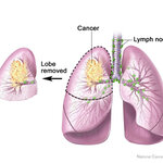 Article teaser image