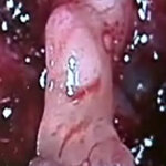 Article teaser image