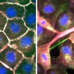 Article teaser image